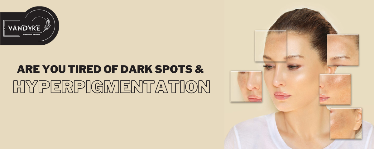 Are you tired of dark spots and hyperpigmentation - Vandyke