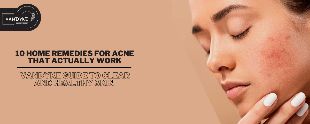 Home Remedies for Acne That Actually Work - Vandyke