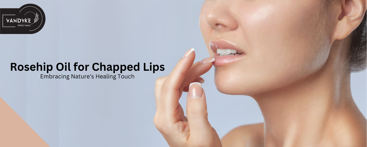 Rosehip Oil for Chapped Lips - Vandyke