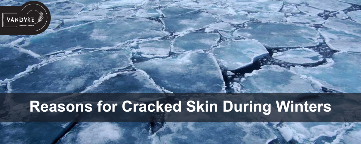 Reasons for Cracked Skin During Winters - Vandyke